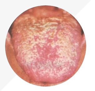 Analysis of High-Definition Tongue Diagnosis Charts: Understanding Health Through Your Tongue (Part 1)