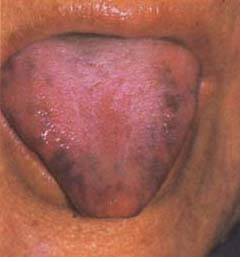 62 High-Definition Tongue Diagnosis Charts with Illustrations (Collector's Edition)
