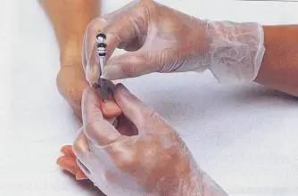 Bloodletting Therapy for 24 Difficult Diseases: A Unique TCM Approach