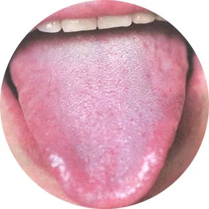 The Most Comprehensive High-Definition Real Tongue Diagnosis: Observing Tongue Patterns to Understand Internal Organs (Collection Edition)