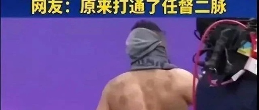 The Mysterious Eastern Power: Cupping Therapy at the Asian Games Village