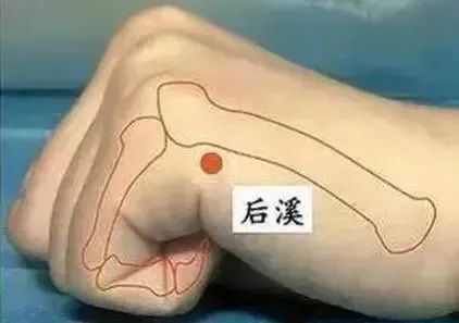 Acupuncture Techniques for Treating Neck, Shoulder, Waist, and Leg Pain: The Three Hand Points and Three Foot Points!
