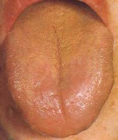 62 High-Definition Tongue Diagnosis Charts with Illustrations (Collector's Edition)