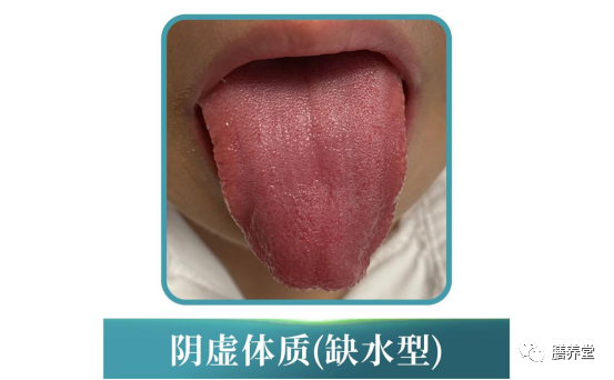 The Nine Constitutions in Traditional Chinese Medicine: Which One Are You?