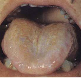 62 High-Definition Tongue Diagnosis Charts with Illustrations (Collector's Edition)