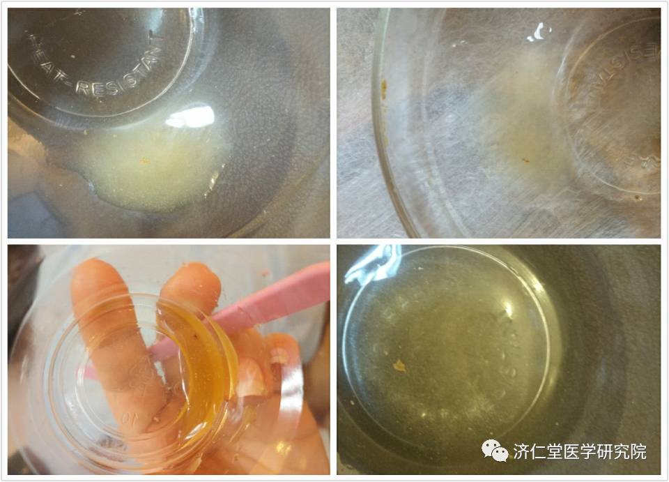 Understanding the Six Evils in Traditional Chinese Medicine