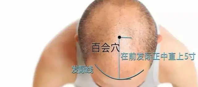 57 Practical Acupuncture Points Everyone Can Use