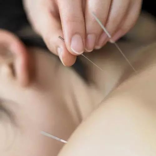 Bloodletting Therapy for 24 Difficult Diseases