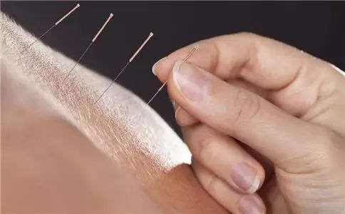Acupuncture Techniques (A Must-Read for Acupuncturists)
