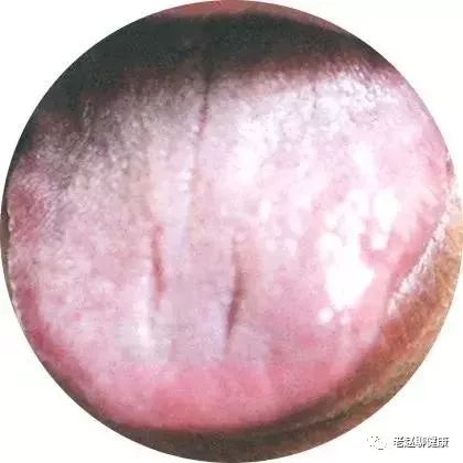 Learn Quick Ways to Observe Tongue Quality and Coating to Understand Your Health and Diseases!