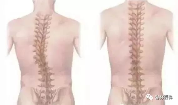27 Massage Techniques for Spinal Disorders in Traditional Chinese Medicine