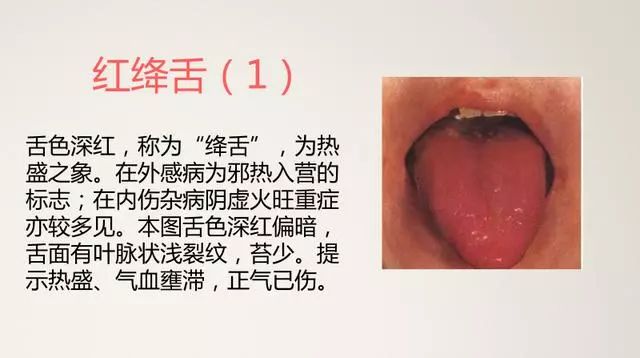 The Most Comprehensive TCM Tongue Diagnosis Atlas: Observe the Tongue, Understand the Whole Body!