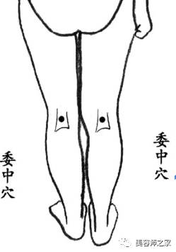 The Therapeutic Benefits of Bloodletting in Traditional Chinese Medicine