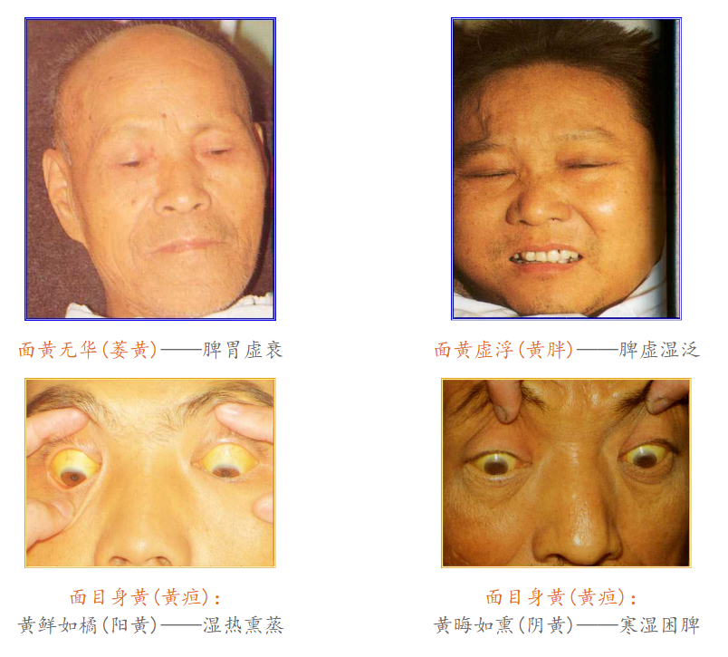 Diagnosis in Traditional Chinese Medicine