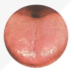 Analysis of High-Definition Tongue Diagnosis Charts: Understanding Health Through Your Tongue (Part 1)
