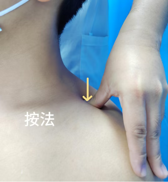 Traditional Chinese Medicine Techniques: An Overview of Tui Na