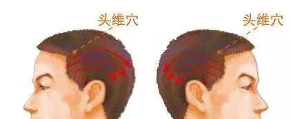 Key Techniques for Gua Sha