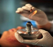 Fire Needle Therapy: A Unique Tool of Traditional Chinese Medicine