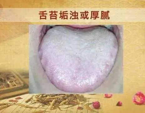 Traditional Chinese Medicine: A Method to Elevate Yang and Eliminate Dampness to Enhance Vitality