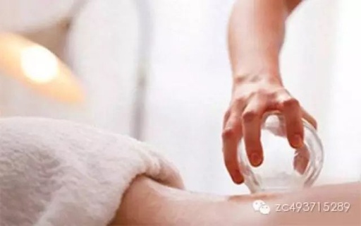 Benefits of Moving Cupping Therapy