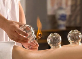 Understanding Cupping Therapy: Common Misconceptions and Precautions