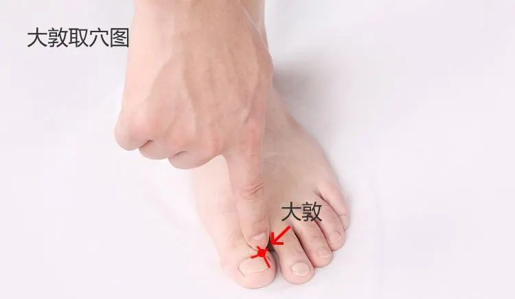 The Remarkable Bloodletting Therapy: A Solution for Various Diseases!