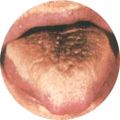 The Most Comprehensive High-Definition Real Tongue Diagnosis: Observing Tongue Patterns to Understand Internal Organs (Collection Edition)