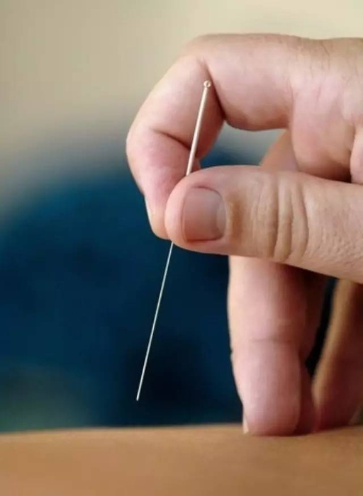 Acupuncture Techniques (1) - Fine Needle Technique