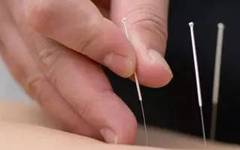 Three Forbidden Acupuncture Points in Acupuncture: Remember These to Get Started