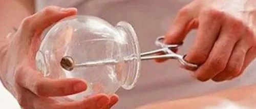 The Miraculous Effects of Cupping on the Navel