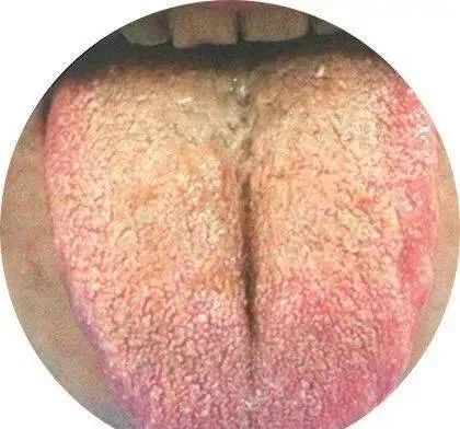 130 High-Definition Tongue Diagnosis Charts (Recommended for Collection)