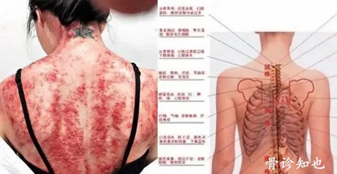 The Essence of Gua Sha: A Must-Read!
