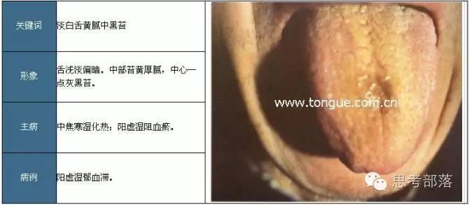 Comprehensive Guide to Tongue Diagnosis (8): 72 Types of Tongue Diagnosis Charts