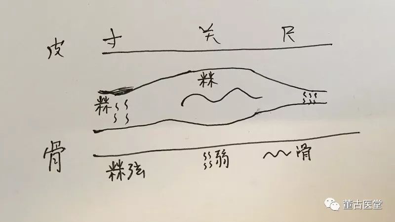 Clinical Application of Xuan Hua Pulse in TCM: A Case Study on Insomnia