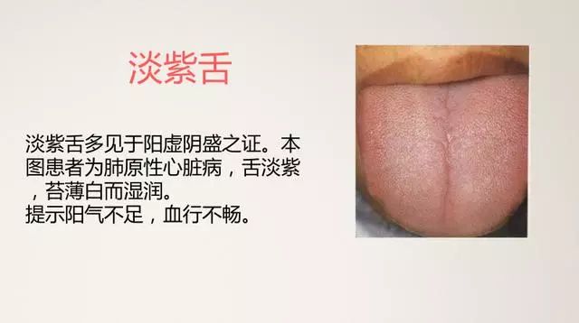 The Most Comprehensive TCM Tongue Diagnosis Atlas: Observe the Tongue, Understand the Whole Body!