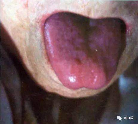 Learning Tongue Diagnosis from Scratch: Part 6 - Tongue Color 4