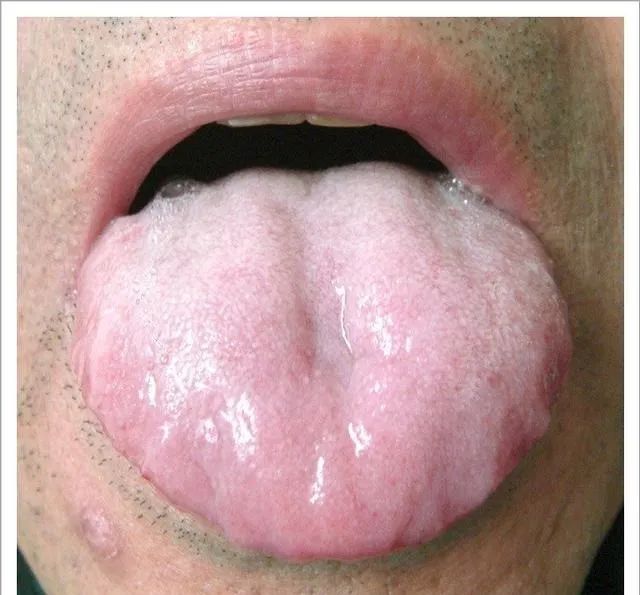 Traditional Chinese Medicine Tongue Diagnosis: 26 Clinical High-Definition Tongue Diagnosis Images with Analysis
