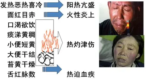 Illustrated Guide to the Eight Principles of Diagnosis in TCM