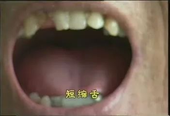 The Health Code Hidden on Your Tongue