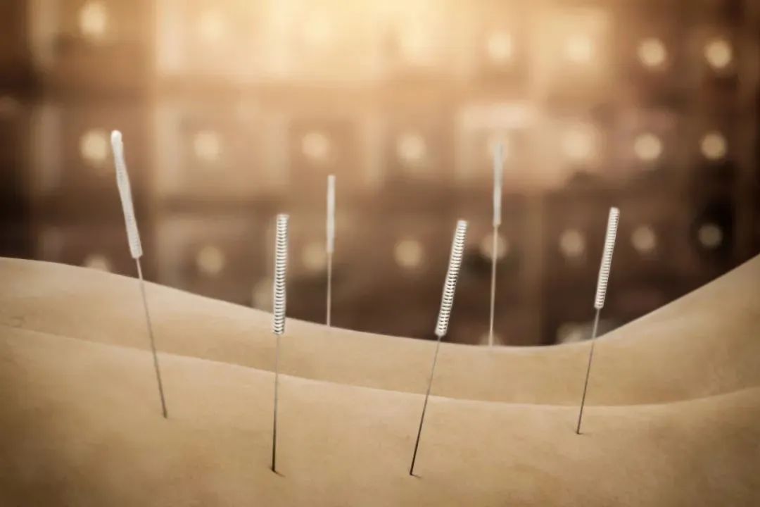 The Efficacy of Bloodletting Therapy in Treating Various Conditions