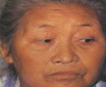 Traditional Chinese Medicine Diagnosis | Observation Diagnosis - Observing Color