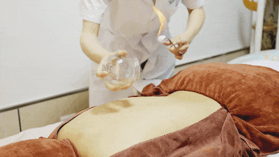 Understanding 'Heat': The Benefits of Cupping Therapy in Summer