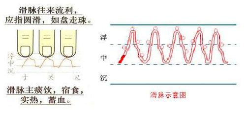 Understanding the Slippery Pulse in Traditional Chinese Medicine