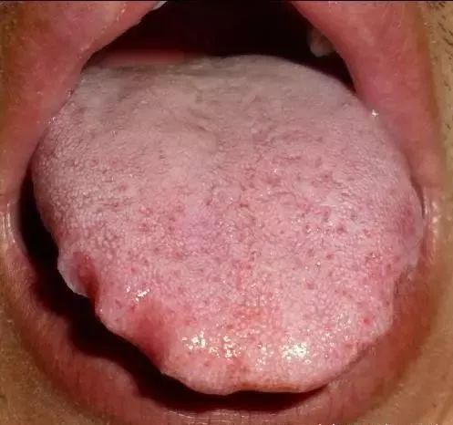 The TCM Tongue Diagnosis Atlas is Here! Observe the Tongue to Understand the Whole Body!