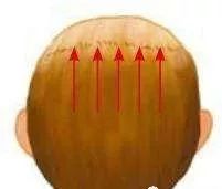Key Techniques for Gua Sha