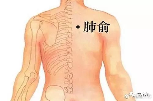 Comprehensive Guide to Cupping Therapy for the Back