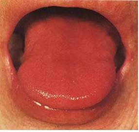 61 High-Definition Tongue Diagnosis Charts: A Visual Reference Collection