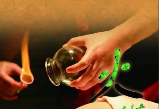 Cupping Therapy in Traditional Chinese Medicine: Meaning, Functions, Contraindications, and Precautions