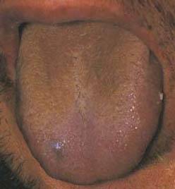 62 High-Definition Tongue Diagnosis Charts with Illustrations (Collector's Edition)