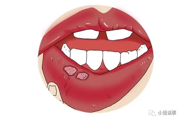 Understanding the Four Types of Pain Associated with Yin Deficiency in TCM